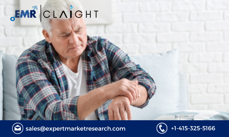 Read more about the article Tardive Dyskinesia Market Size, Share, Growth Report and Forecast 2024-2032