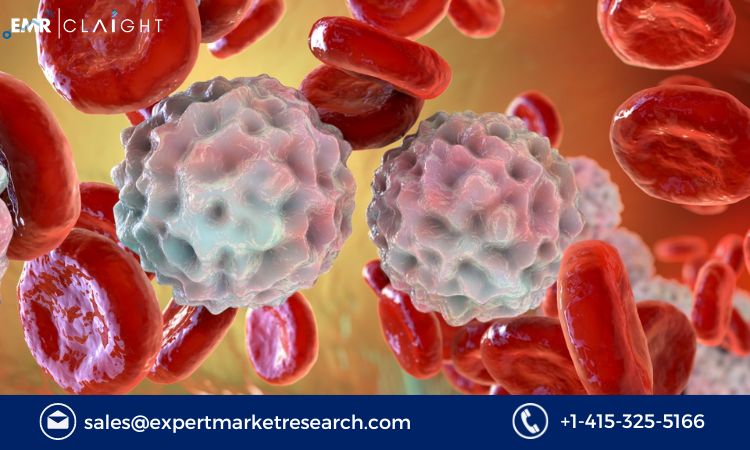 Read more about the article Acute Lymphoblastic Leukemia Therapeutics Market Size, Share, Trends, Outlook, Growth, Analysis, Report and Forecast 2024-2032