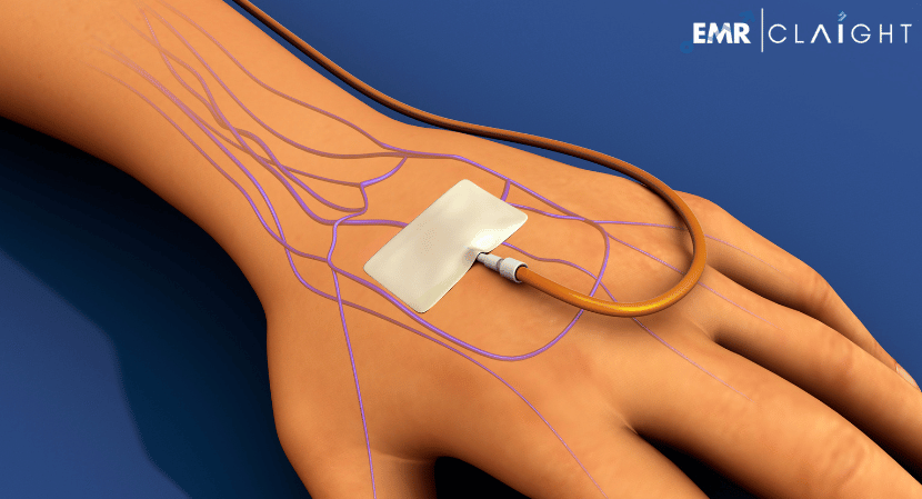 Read more about the article Global Intrauterine Pressure Catheters Market Size, Share, Price, Report and Forecast 2024-2032