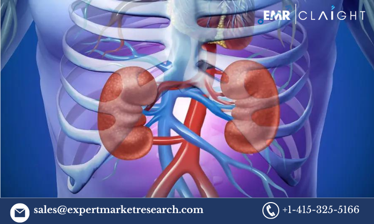 Read more about the article Acute Kidney Injury Treatment Market Size, Share, Growth, Trends, Analysis, Report and Forecast 2024-2032