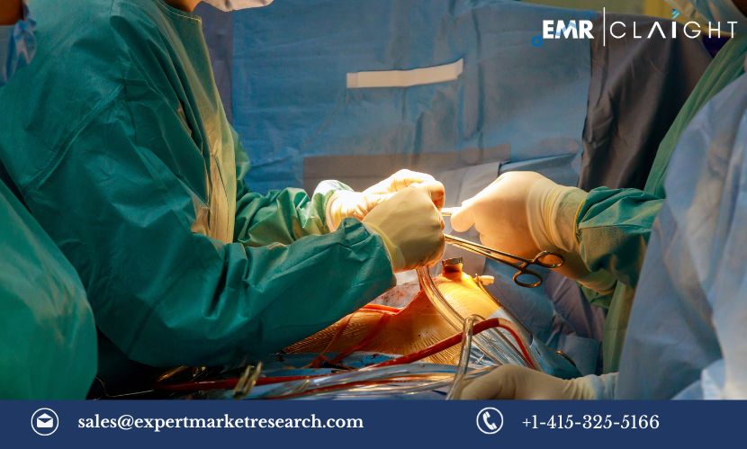 Read more about the article Global Aortic Valve Replacement Devices Market Size, Share, Growth, Trends & Analysis, Report and Forecast 2024-2032