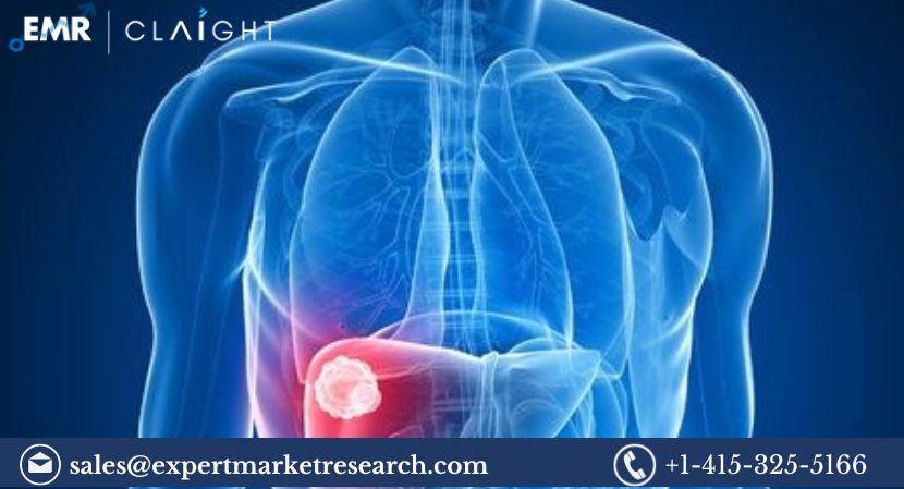 Read more about the article North America Tumor Ablation Market Size, Share, Trends, Analysis, Growth, Report and Forecast 2024-2032