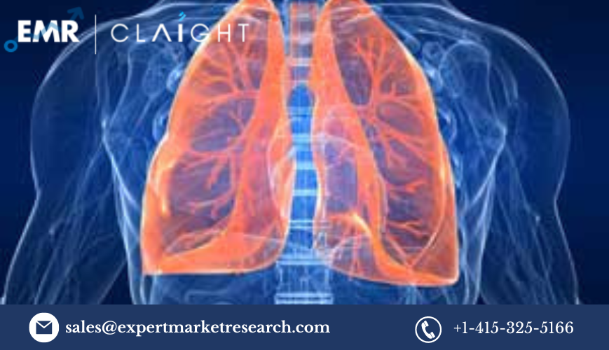 Read more about the article Acute Lung Injury Treatment Market Report and Forecast 2024-2032