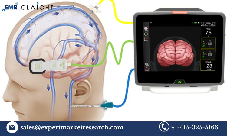 Read more about the article Brain Monitoring Market Size, Share, Trends, Research, Industry, Report and Forecast 2032