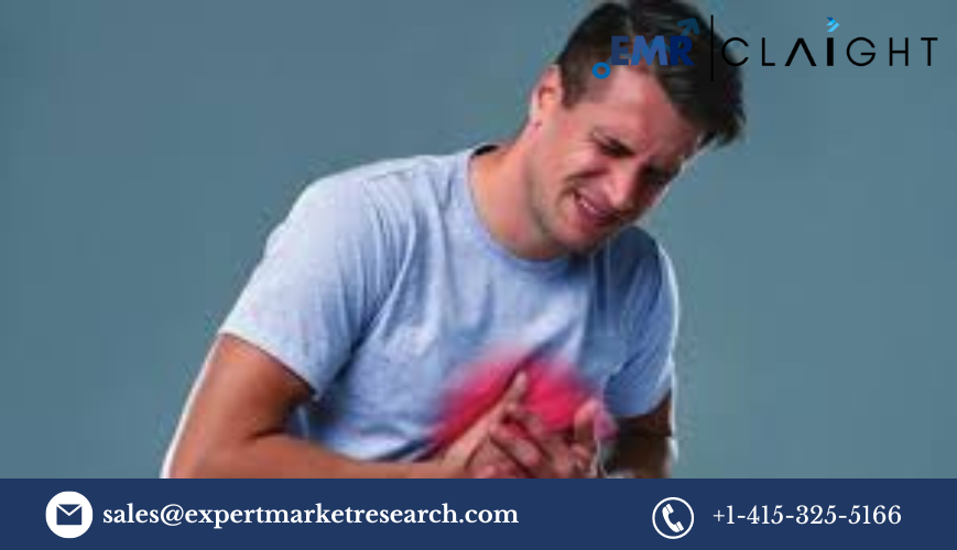 Read more about the article Global Cardiac Biomarker Testing Market Size, Share, Report and Forecast 2024-2032