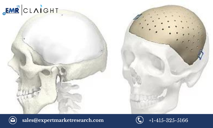 Read more about the article Cranial Implants Market Size, Share, Growth, Trends, Analysis, Report and Forecast 2024-2032