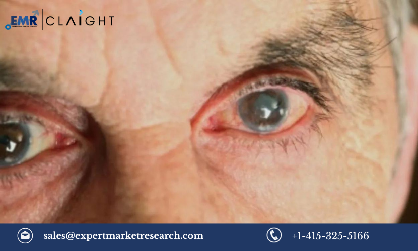 Read more about the article Diabetic Macular Edema Market Size, Share, Trends, Analysis, Growth Report and Forecast 2024-2032