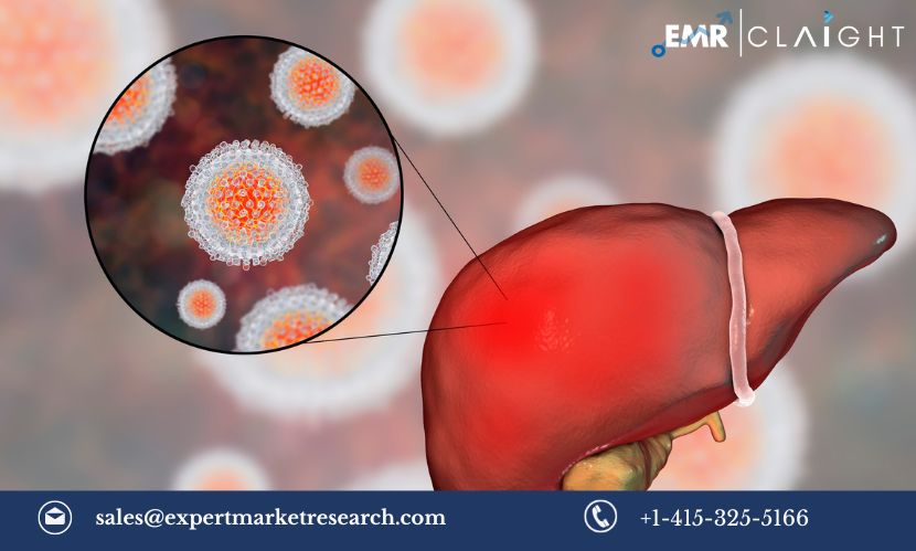 Read more about the article Global Hepatitis B Infection Treatment Market Size, Share, Growth, Trends & Analysis, Report and Forecast 2024-2032