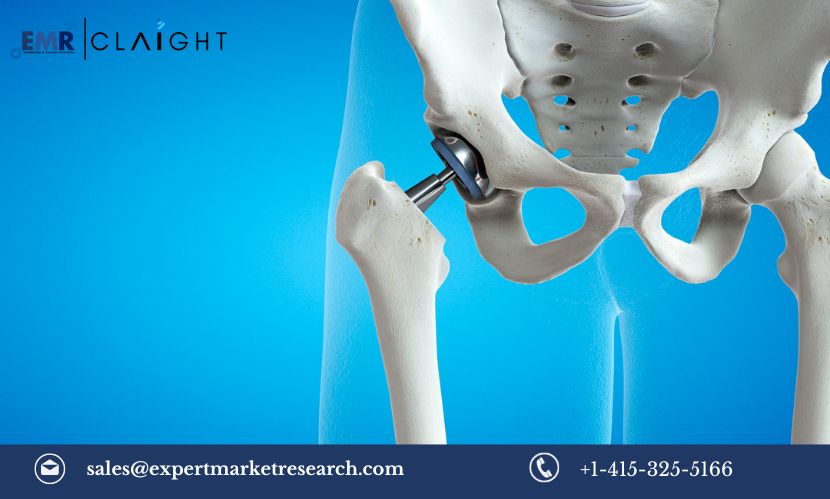 Read more about the article Global Orthopaedic Digit Implants Market Size, Share, Growth, Trends & Analysis, Report and Forecast 2024-2032