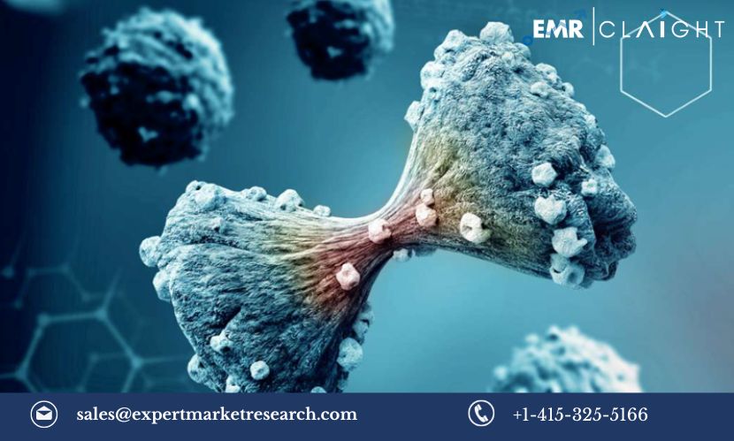 Read more about the article Global Radiotheranostics Market Size, Share, Growth, Trends & Analysis, Report and Forecast 2024-2032