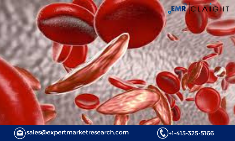 Read more about the article North America Hemoglobinopathies Market Size, Share, Trends, Growth, Report and Forecast 2024-2032