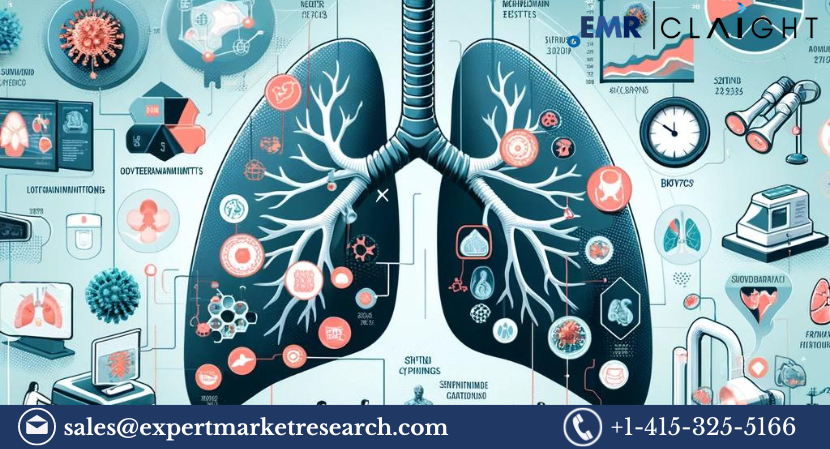 Read more about the article Global Lung Cancer Screening Market Report and Forecast 2024-2032