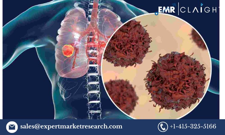 Read more about the article Lung Cancer Therapeutics Market Size, Share, Trends, Growth, Report and Forecast 2024-2032