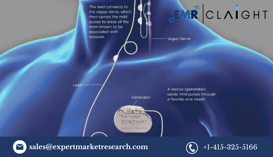 Read more about the article Neuromodulation Devices Market Size, Share, Growth, Report 2024-2032