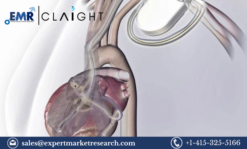 Read more about the article Smart Implantable Pumps Market Size, Share, Report and Forecast 2024-2032