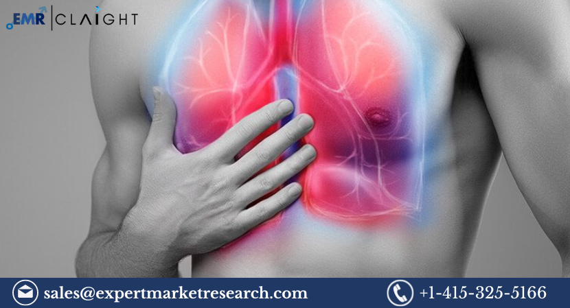 Read more about the article Acute Respiratory Syndrome Treatment Market Size, Share, Trends, Report and Forecast 2024-2032