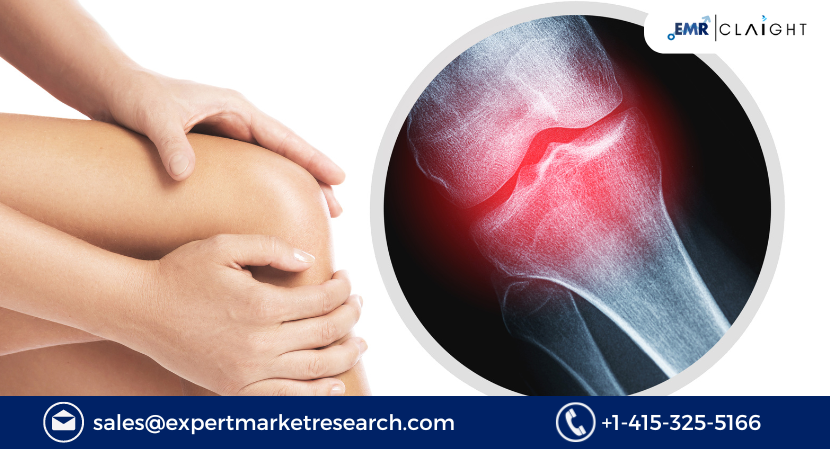 Read more about the article Global Bone and Joint Health Ingredients Market Size, Share, Trends, Growth, Analysis, Report and Forecast 2024-2032