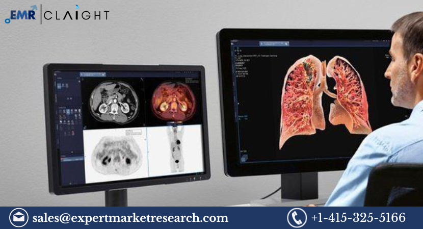 Read more about the article Cardiovascular Information System Market Size, Share, Trends, Market Report and Forecast 2024-2032