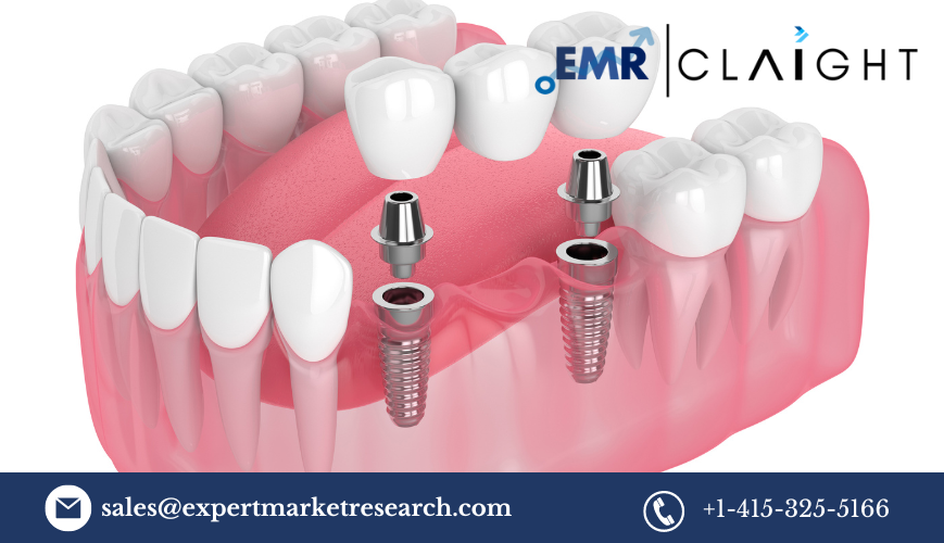 Read more about the article Dental 3D Printing Market Size, Share, Report and Forecast 2024-2032