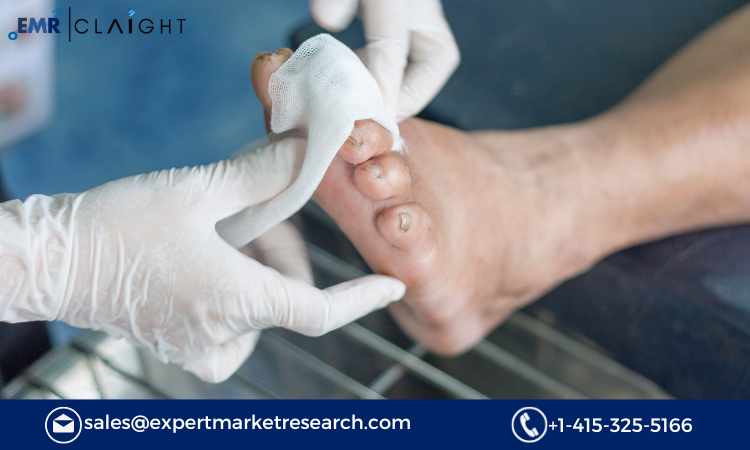 Read more about the article Diabetic Foot Ulcers Market Size, Share, Trends, Growth, Analysis, Report and Forecast 2024-2032