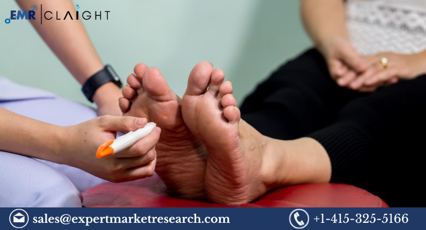 Read more about the article Diabetic Neuropathy Market Size, Share, Trends, Report and Forecast 2024-2032