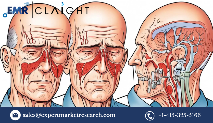 You are currently viewing Giant Cell Arteritis Treatment Market Report and Forecast 2024-2032