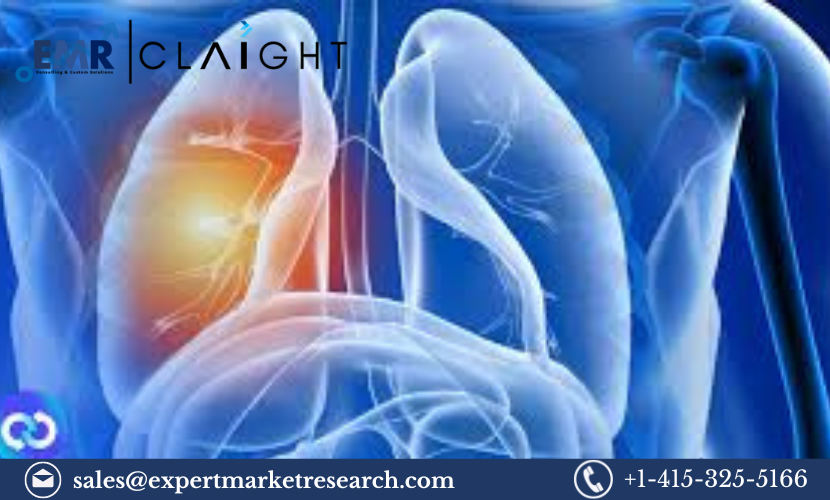 Read more about the article Non-Small Cell Lung Cancer Treatment Market Size, Share, Report and Forecast 2024-2032