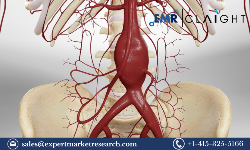 Read more about the article North America Aortic Stent Graft Market Size, Share, Report and Forecast 2024-2032