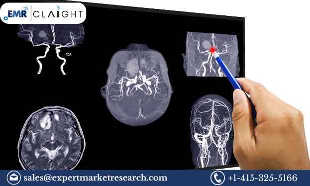 Read more about the article North America Intracranial Aneurysm Market Size, Share, Trends, Growth, Analysis, Report and Forecast 2024-2032