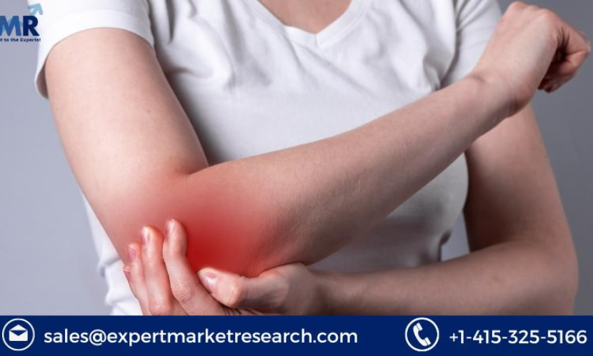 Read more about the article Global Topical Pain Relief Market Report and Forecast 2024-2032