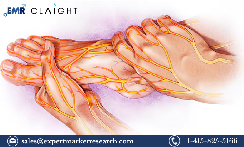 Read more about the article Peripheral Neuropathy Treatment Market Size, Share, Trends, Growth, Report and Forecast 2024-2032