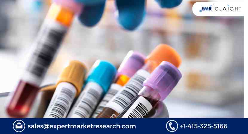 Read more about the article Global Clinical Trials Support Services Market Size, Share, Trends, Growth, Analysis, Report and Forecast 2024-2032