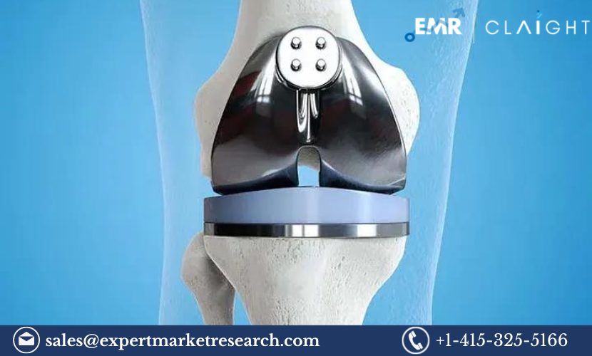 Read more about the article Knee Replacement Market Size, Share, Report and Forecast 2024-2032