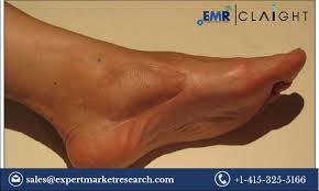 Read more about the article Synovial Sarcoma Market Report and Forecast 2024-2032