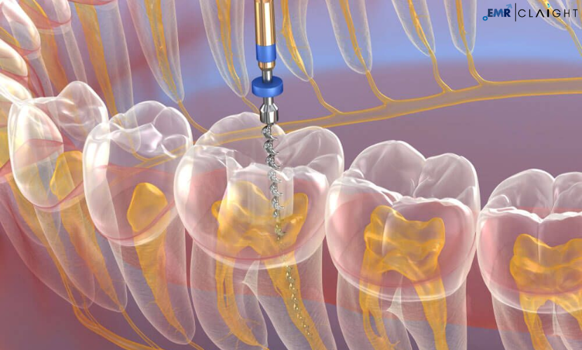 Read more about the article Global Endodontics Market Report and Forecast 2024-2032