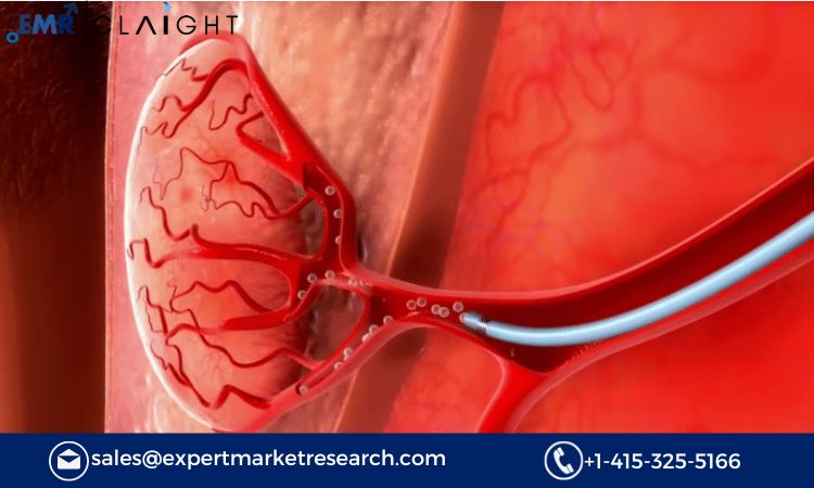 You are currently viewing Global Microcatheter Market Size, Share, Trends, Report and Forecast 2024-2032