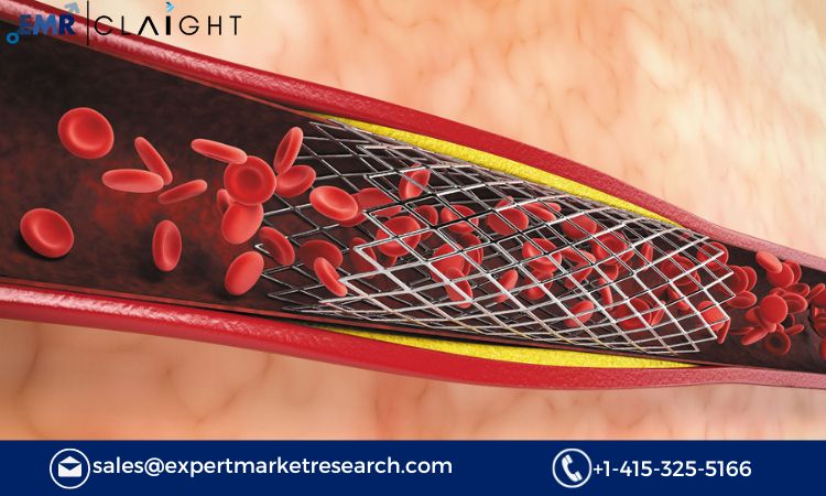 Read more about the article Global Stents Market Size, Share, Analysis, Trends, Report and Forecast 2024-2032