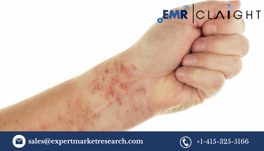 Read more about the article Immune Thrombocytopenia Market Size, Share, Report and Forecast 2024-2032