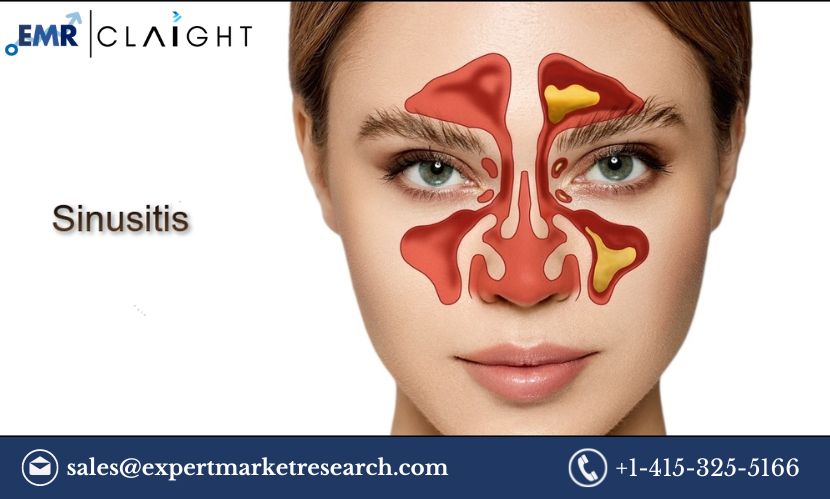 You are currently viewing Sinusitis Drugs Market Size, Share, Trends, Growth, Report and Forecast 2024-2032